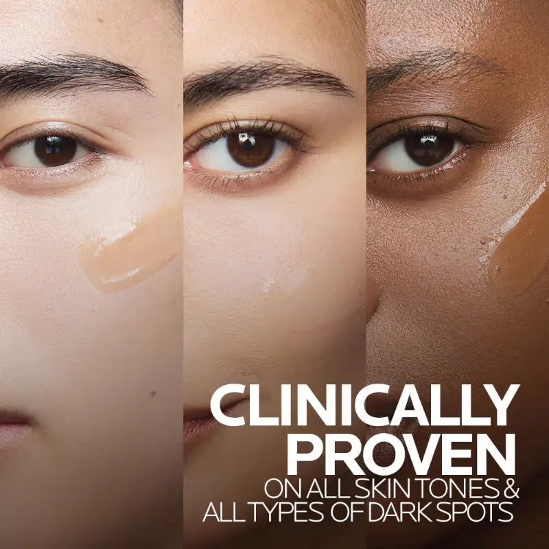 Mela B3 Serum, For Anti-Dark Spots & Pigmented Skin with Melasyl + 10% Niacinamide (30ml) La Roche-Posay