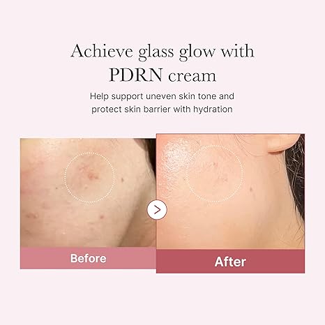PDRN Pink Hyaluronic Moisturizing Cream(50ml) Medicube