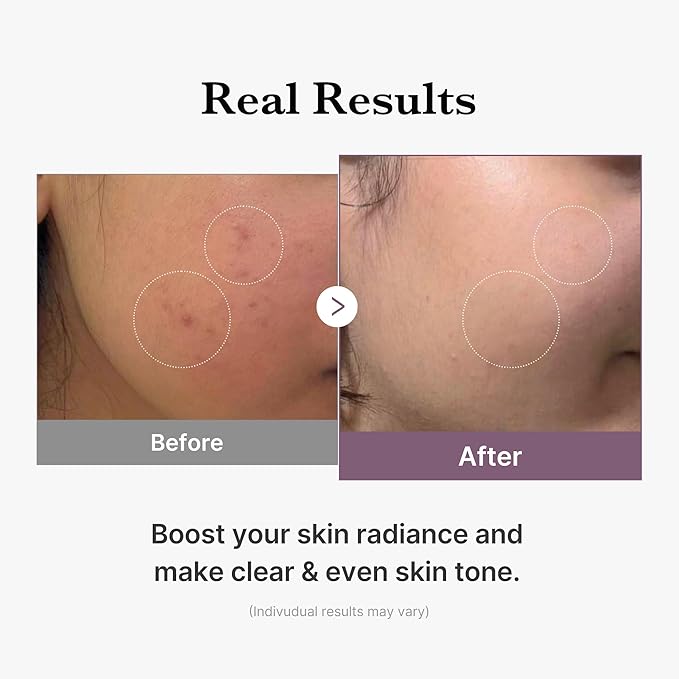 Age-R Glutathione Glow Toner(140ml) Medicube