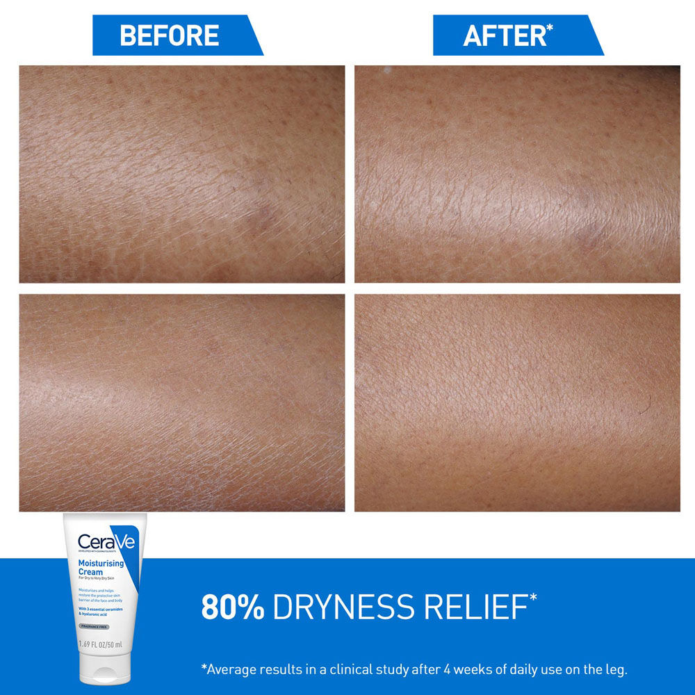 Moisturizer Cream For Dry Skin With Ceramides & Hyaluronic Acid For Barrier Repair(50ml) CeraVe