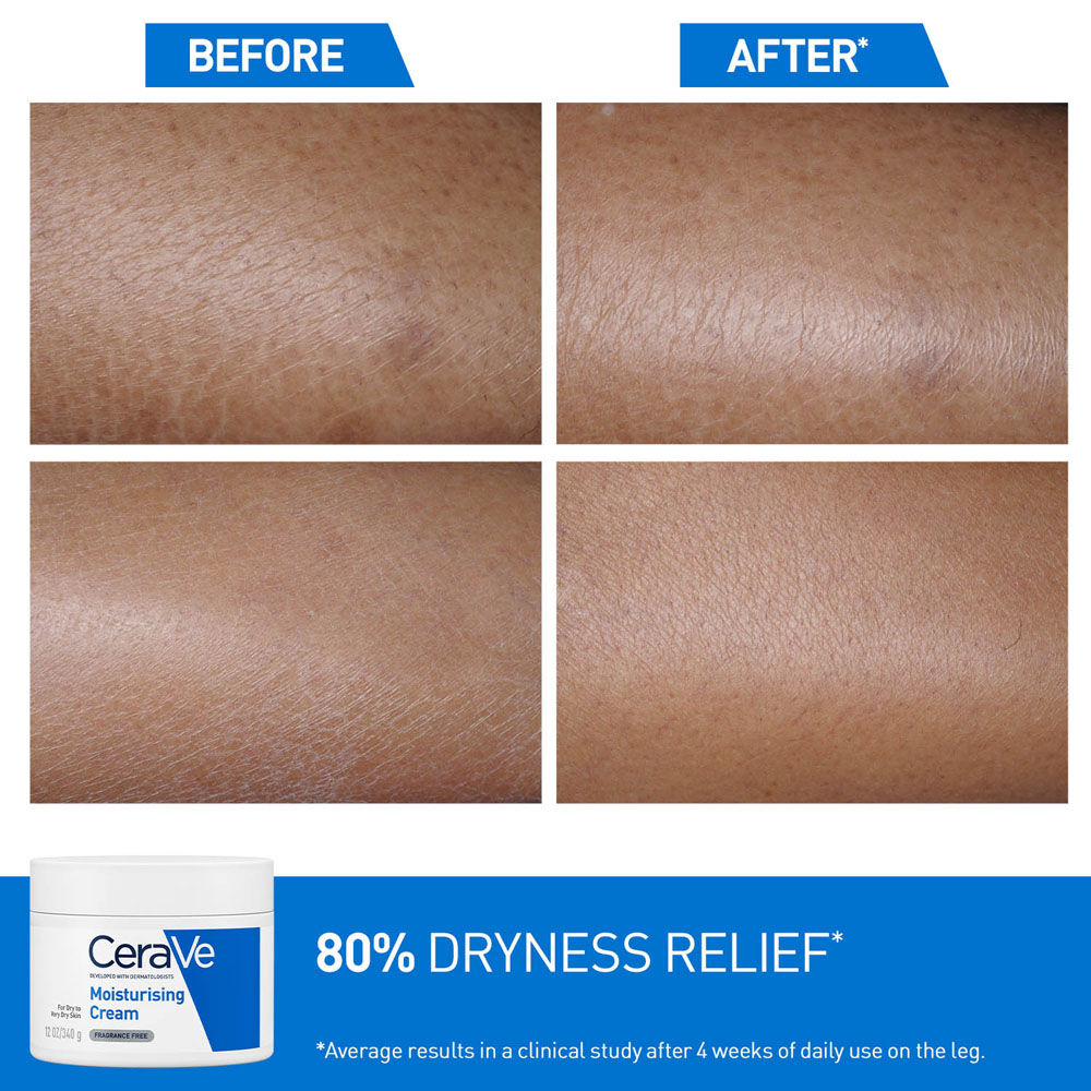 Moisturizer For Dry Skin, Barrier Repair Cream with Ceramides, Dermatologist recommended(340 g) CeraVe