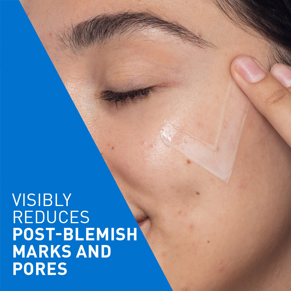 Resurfacing Retinol Serum, Reduces Acne Marks with Licorice Root Extract & Niacinamide(30ml) CeraVe