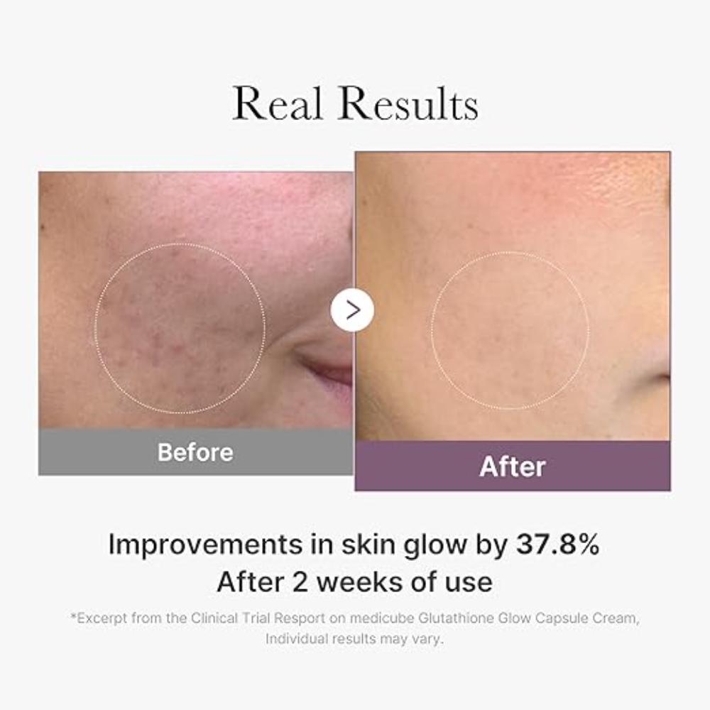 Age-R Glutathione Glow Capsule Cream(50ml) Medicube