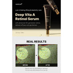 Deep Vita A Retinol Serum(30ml) Medicube